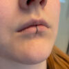 Hinged Segment Clicker -Titanium - Image 2